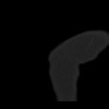 SPORK, NICO - 22.03.1976 - 02.08.2022 - CT obere Extremität - 17:59:07
